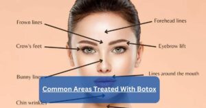 Common Areas Treated With Botox